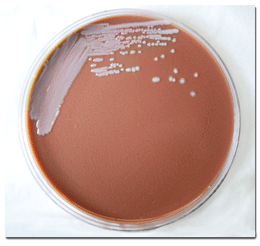 Gram negative Burkholderia mallei bacteria on medium of chocolate agar