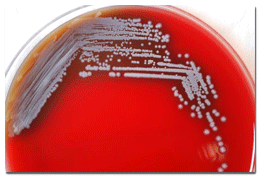 Gram-negative Burkholderia pseudomallei bacteria