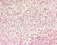 Francisella microscopic