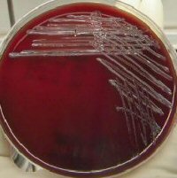 Francisella tularensis 48 hours Horse Blood