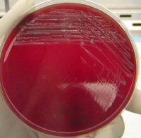 Francisella tularensis on CHAB
