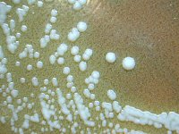 Francisella tularensis on CHAB