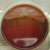 Petis on Horse Blood Agar 48hrs