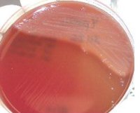 Petis on Horse Blood Agar 72hours