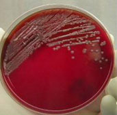 Petis on Sheep Blood Agar 48hours