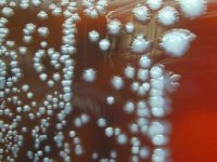 Yersinia Pestis Colonies
