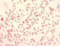 Yersinia Pestis Microscopic