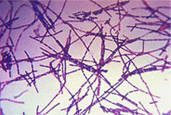 Banthracis Gram Stain