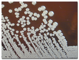 Burkholderia pseudomallei grown on sheep blood agar for 96 hours